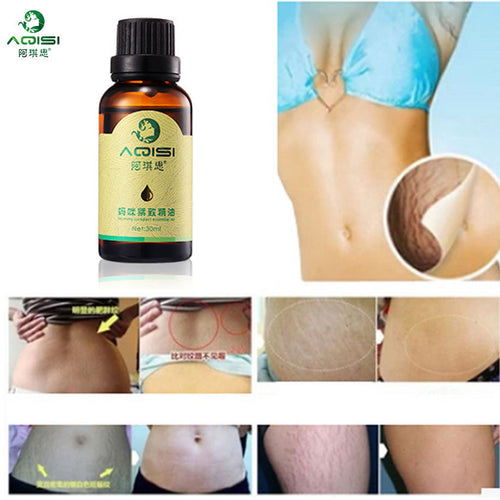 Powerful To Stretch Marks Maternity Essential Oil Skin Care Treatment Cream for Stretch Mark Remover Obesity Postpartum Repair - Futurmama