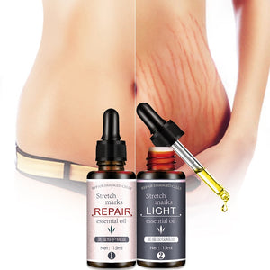 Stretch Marks Remover Essential Oil Skin Care Treatment Cream For Stretch Mark Removal Maternity Slackline For Pregnant Oils - Futurmama