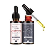 Stretch Marks Remover Essential Oil Skin Care Treatment Cream For Stretch Mark Removal Maternity Slackline For Pregnant Oils - Futurmama