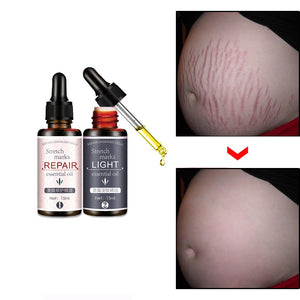 Stretch Marks Remover Essential Oil Skin Care Treatment Cream For Stretch Mark Removal Maternity Slackline For Pregnant Oils - Futurmama