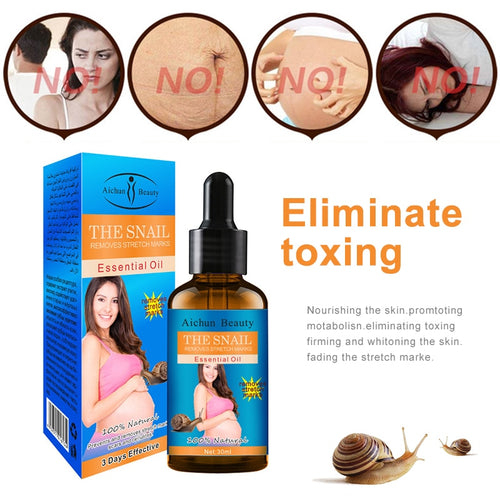 30ml Pregnancy Stretch Mark Removal Essential Oil Natural Snail Extract Repairing Oil Get Rid of Stretch Mark for Women TSLM1 - Futurmama