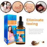 30ml Pregnancy Stretch Mark Removal Essential Oil Natural Snail Extract Repairing Oil Get Rid of Stretch Mark for Women TSLM1 - Futurmama