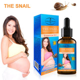 30ml Pregnancy Stretch Mark Removal Essential Oil Natural Snail Extract Repairing Oil Get Rid of Stretch Mark for Women TSLM1 - Futurmama